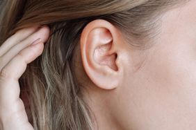 Close-up of a woman's ear with blackheads