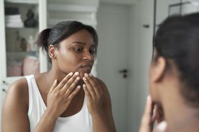 Young African-American woman in the bathroom having acne problems with face